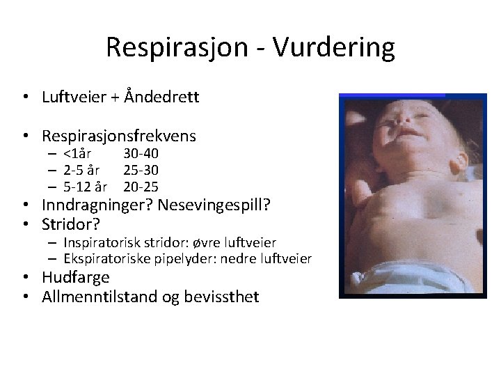 Respirasjon - Vurdering • Luftveier + Åndedrett • Respirasjonsfrekvens – <1år 30 -40 –