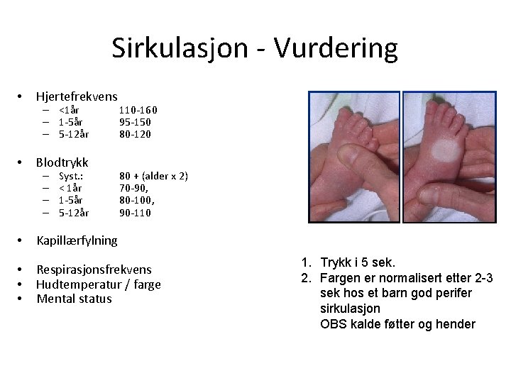 Sirkulasjon - Vurdering • Hjertefrekvens • Blodtrykk • Kapillærfylning • • • Respirasjonsfrekvens Hudtemperatur