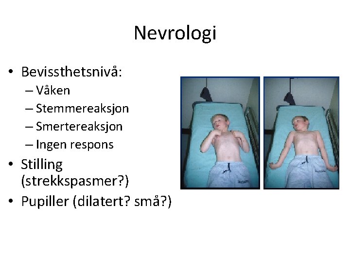 Nevrologi • Bevissthetsnivå: – Våken – Stemmereaksjon – Smertereaksjon – Ingen respons • Stilling