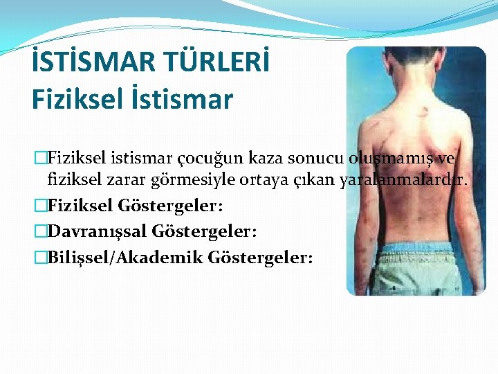 İSTİSMAR TÜRLERİ Fiziksel İstismar �Fiziksel istismar çocuğun kaza sonucu oluşmamış ve fiziksel zarar görmesiyle İSTİSMAR TÜRLERİ Fiziksel İstismar �Fiziksel istismar çocuğun kaza sonucu oluşmamış ve fiziksel zarar görmesiyle