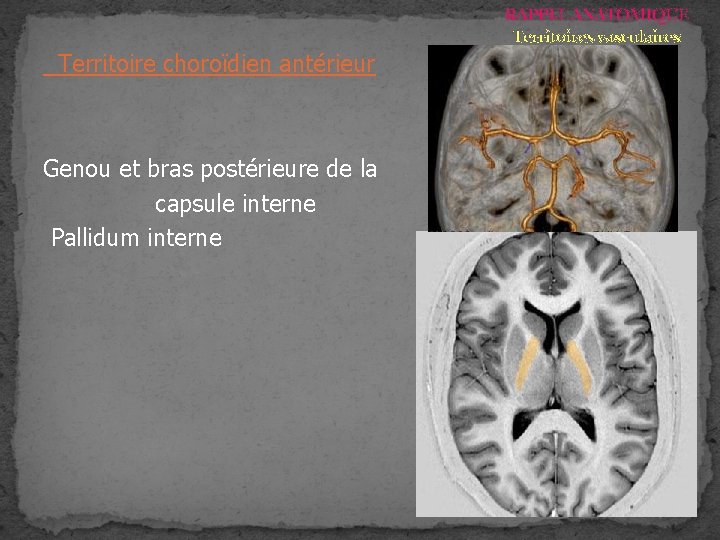RAPPEL ANATOMIQUE Territoires vasculaires Territoire choroïdien antérieur Genou et bras postérieure de la capsule RAPPEL ANATOMIQUE Territoires vasculaires Territoire choroïdien antérieur Genou et bras postérieure de la capsule