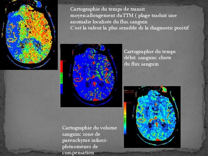 Cartographie du temps de transit moyen: allongement du. TTM ( plage traduit une anomalie