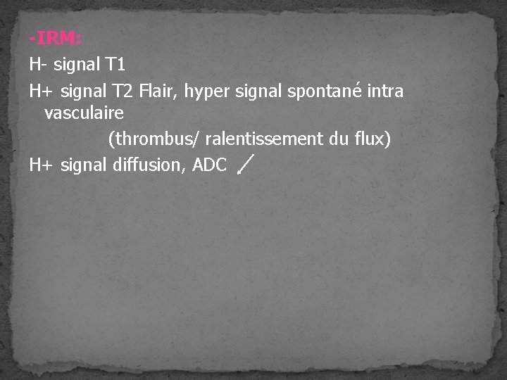 -IRM: H- signal T 1 H+ signal T 2 Flair, hyper signal spontané intra -IRM: H- signal T 1 H+ signal T 2 Flair, hyper signal spontané intra