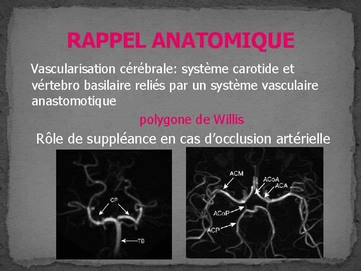 RAPPEL ANATOMIQUE Vascularisation cérébrale: système carotide et vértebro basilaire reliés par un système vasculaire RAPPEL ANATOMIQUE Vascularisation cérébrale: système carotide et vértebro basilaire reliés par un système vasculaire
