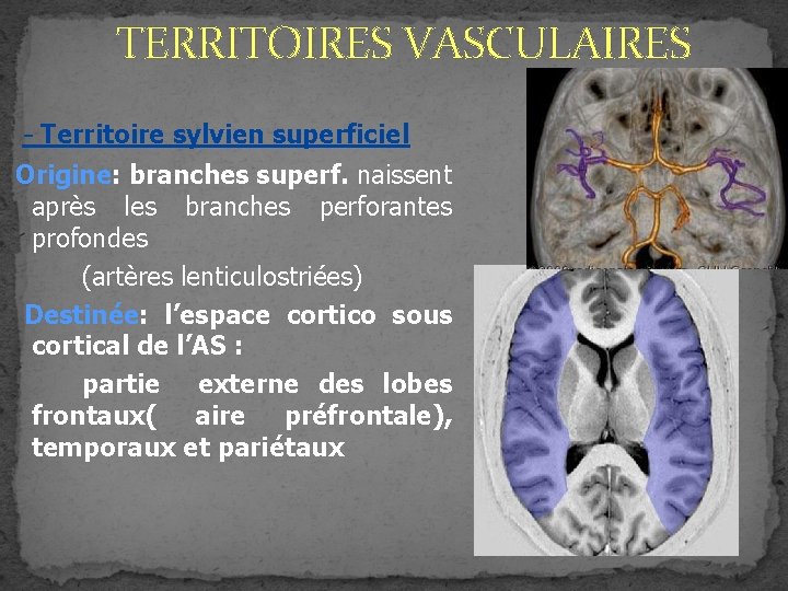 TERRITOIRES VASCULAIRES - Territoire sylvien superficiel Origine: branches superf. naissent après les branches perforantes TERRITOIRES VASCULAIRES - Territoire sylvien superficiel Origine: branches superf. naissent après les branches perforantes