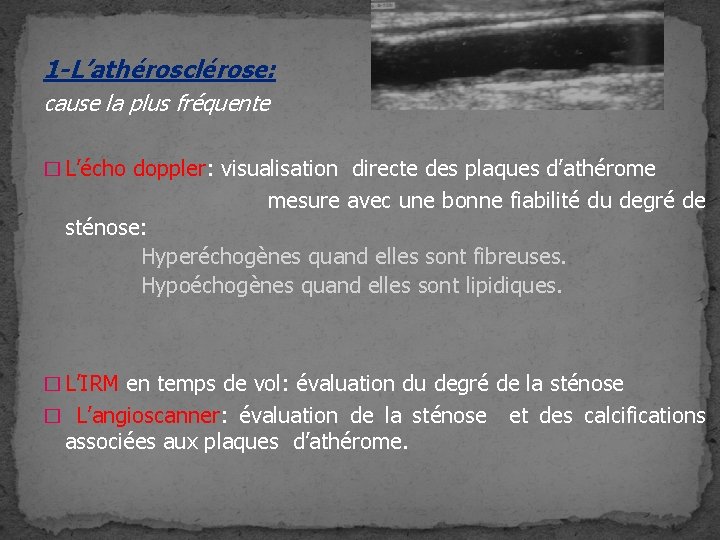 1 -L’athérosclérose: cause la plus fréquente � L’écho doppler: visualisation directe des plaques d’athérome