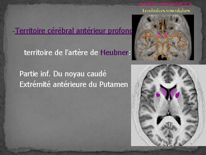 RAPPEL ANATOMIQUE Territoires vasculaires -Territoire cérébral antérieur profond territoire de l’artère de Heubner: Partie