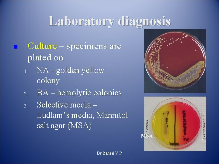 Laboratory diagnosis n Culture – specimens are plated on 1. 2. 3. NA -