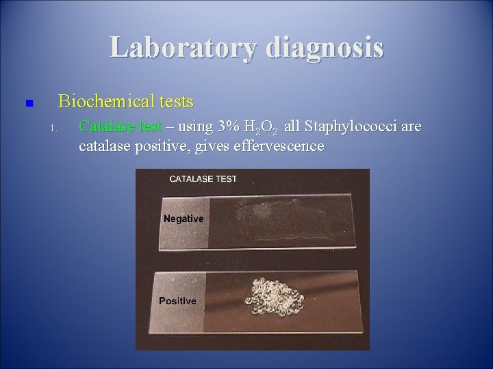 Laboratory diagnosis Biochemical tests n 1. Catalase test – using 3% H 2 O