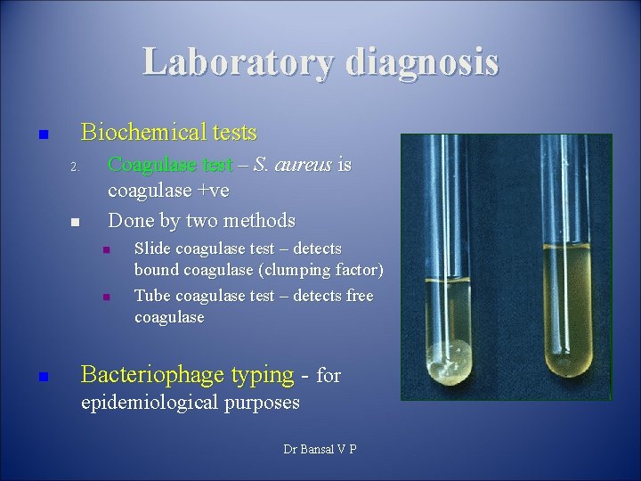 Laboratory diagnosis Biochemical tests n 2. n Coagulase test – S. aureus is coagulase