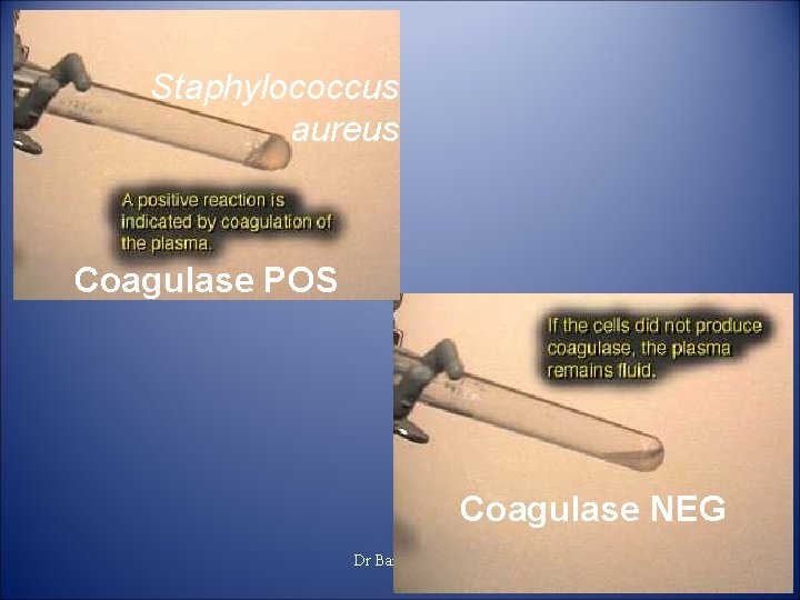 Staphylococcus aureus Coagulase POS Coagulase NEG Dr Bansal V P 