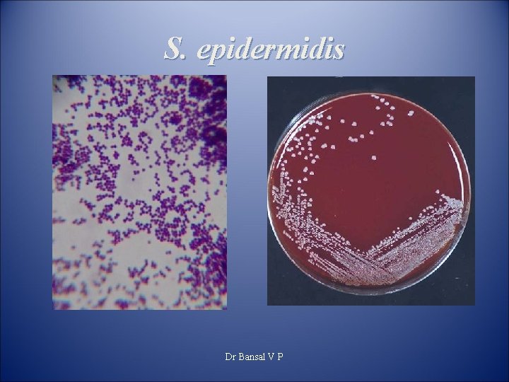 S. epidermidis Dr Bansal V P 