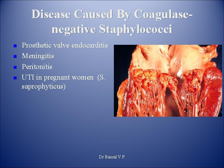 Disease Caused By Coagulasenegative Staphylococci n n Prosthetic valve endocarditis Meningitis Peritonitis UTI in