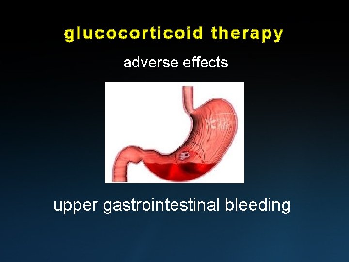 glucocorticoid therapy adverse effects upper gastrointestinal bleeding 