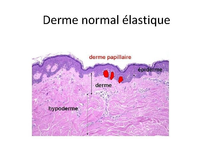 Derme normal élastique 