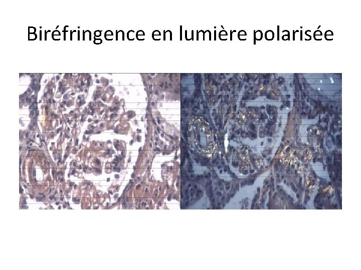 Biréfringence en lumière polarisée 