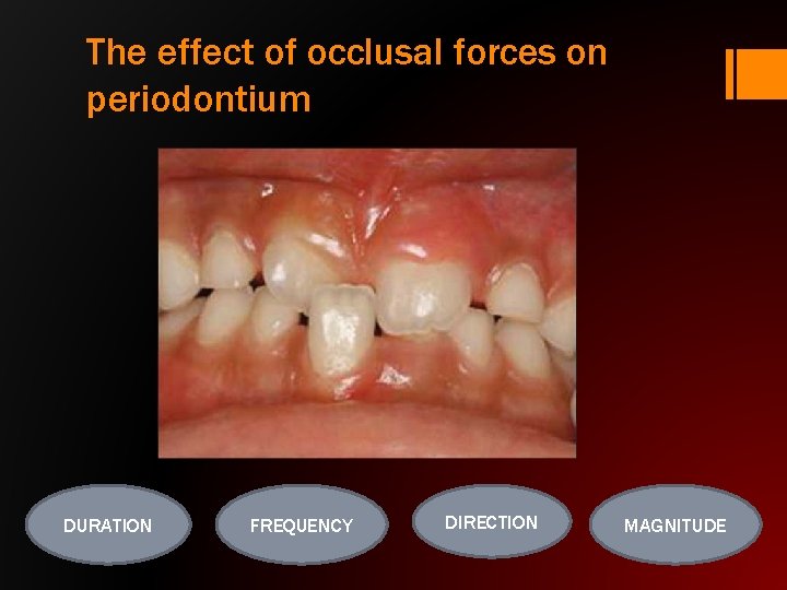The effect of occlusal forces on periodontium DURATION FREQUENCY DIRECTION MAGNITUDE 