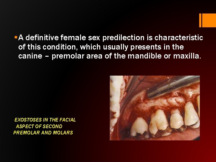 § A definitive female sex predilection is characteristic of this condition, which usually presents