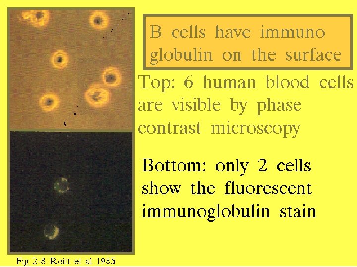 20 Immunglobulin on B cells 2/27/2021 