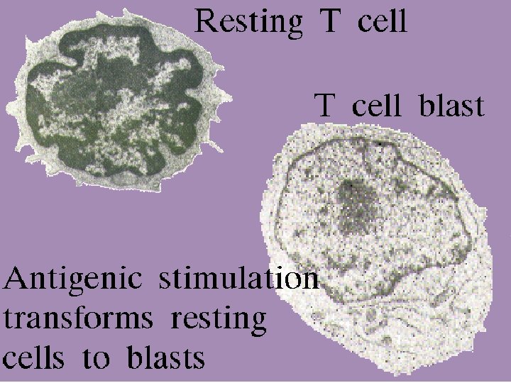 30 T cell transformation 2/27/2021 