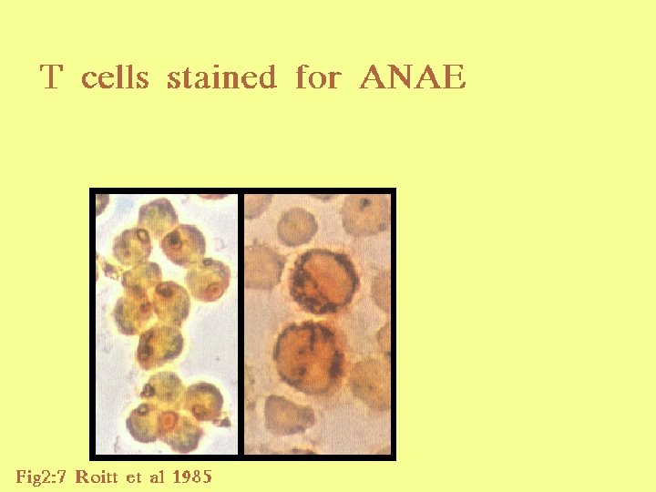 31 T cells ANAE stain 2/27/2021 