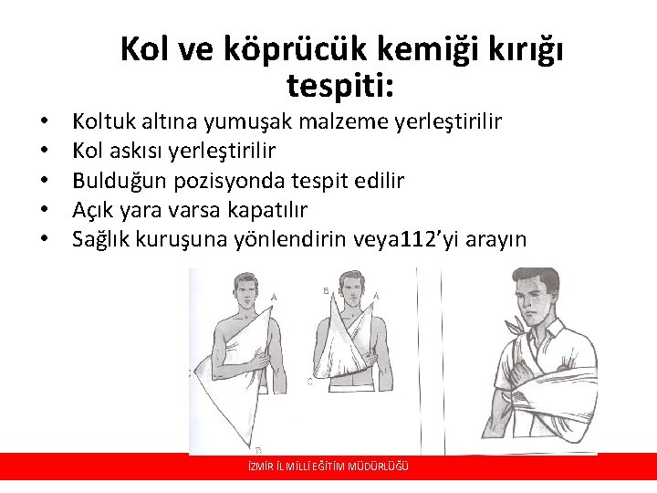  • • • Kol ve köprücük kemiği kırığı tespiti: Koltuk altına yumuşak malzeme