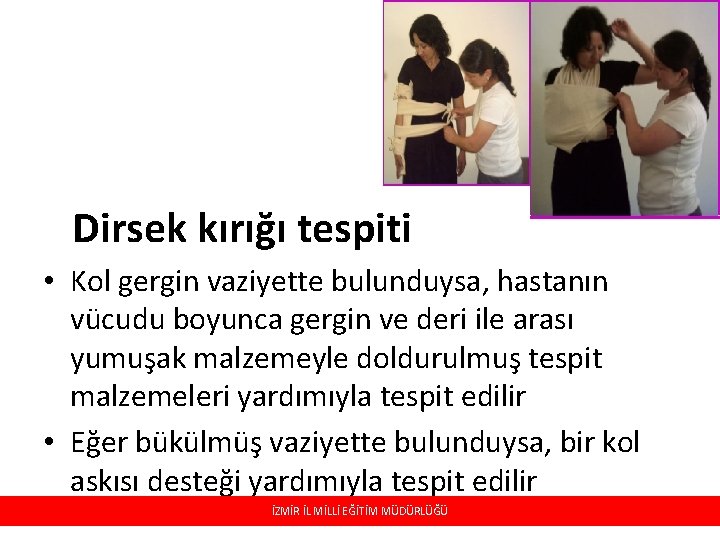 Dirsek kırığı tespiti • Kol gergin vaziyette bulunduysa, hastanın vücudu boyunca gergin ve deri