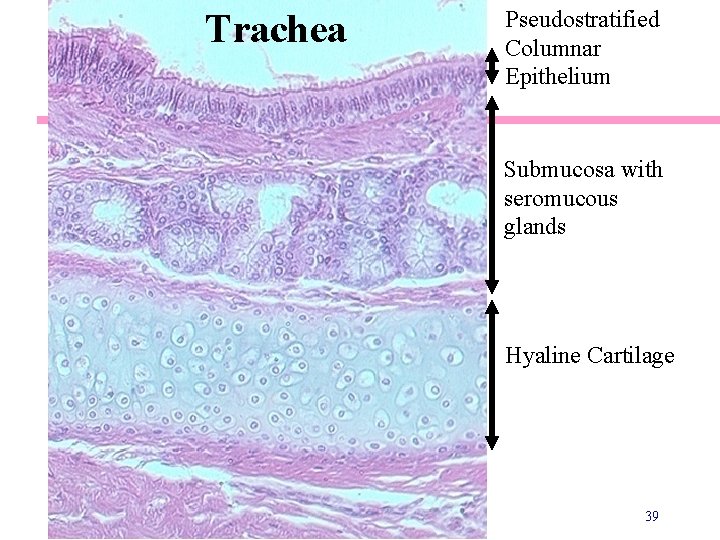 Trachea Pseudostratified Columnar Epithelium Submucosa with seromucous glands Hyaline Cartilage 39 