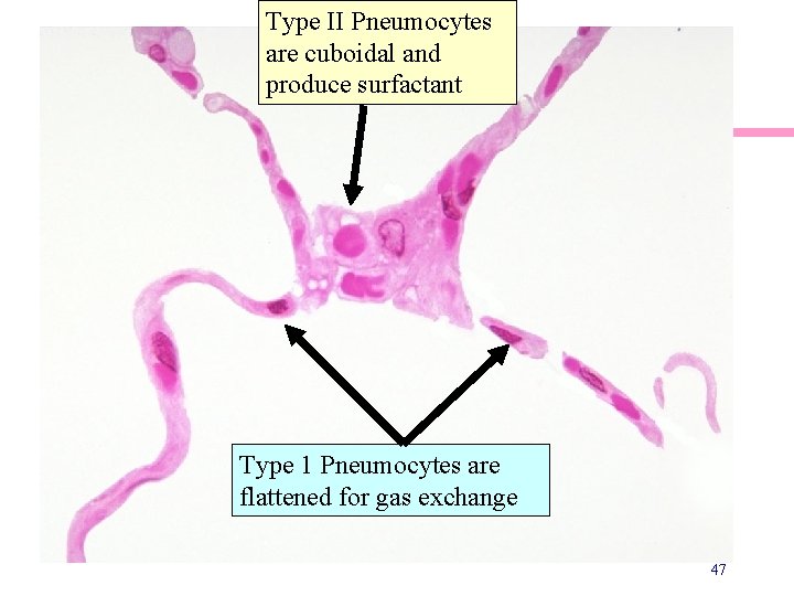 Type II Pneumocytes are cuboidal and produce surfactant Type 1 Pneumocytes are flattened for