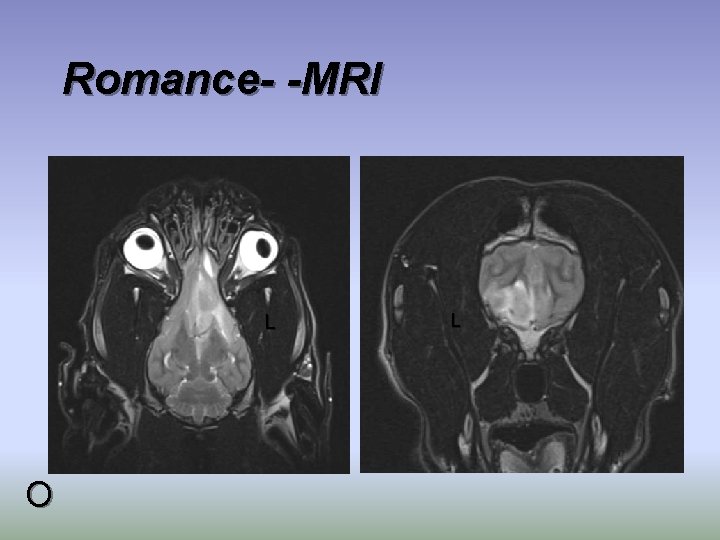 Romance- -MRI L O L 