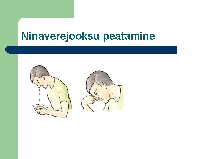 Ninaverejooksu peatamine 