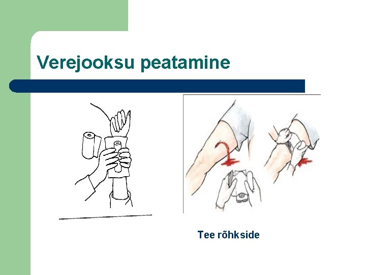 Verejooksu peatamine Tee rõhkside 