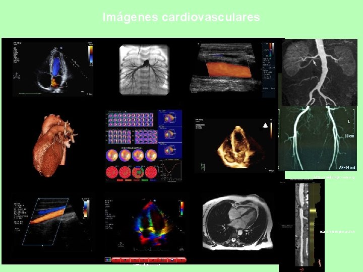 Imágenes cardiovasculares http: //radiology. rsna. org http: //radiologie. usz. ch www. digison. net 