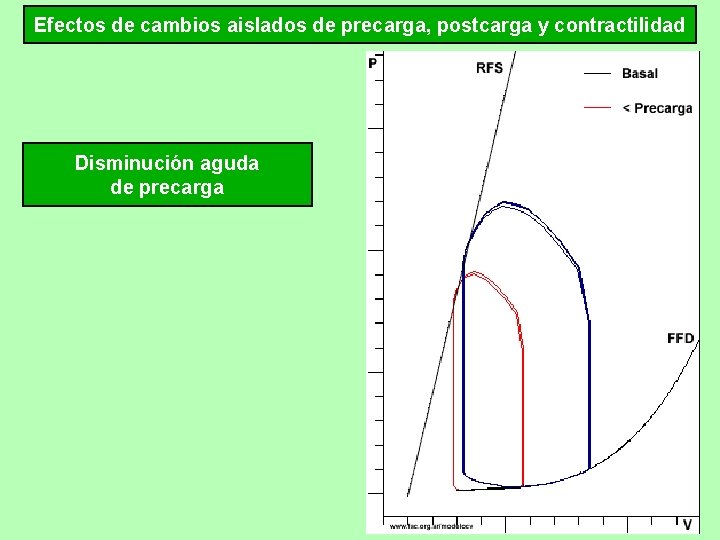 Efectos de cambios aislados de precarga, postcarga y contractilidad Disminución aguda de precarga 