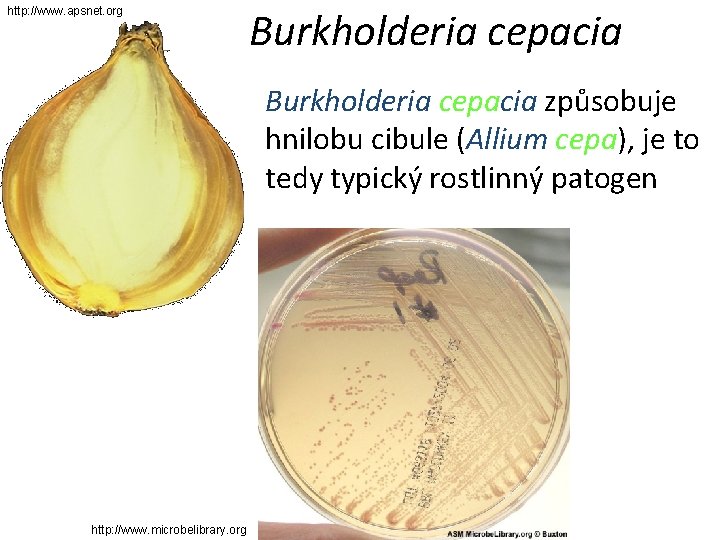http: //www. apsnet. org Burkholderia cepacia způsobuje hnilobu cibule (Allium cepa), je to tedy