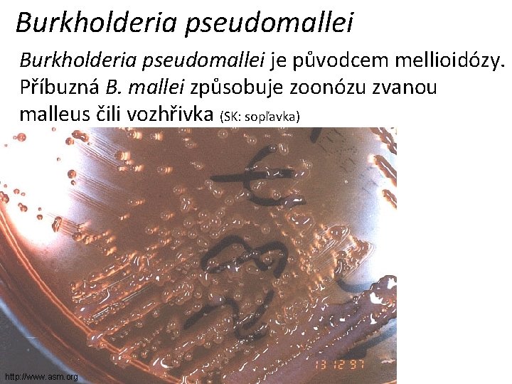 Burkholderia pseudomallei je původcem mellioidózy. Příbuzná B. mallei způsobuje zoonózu zvanou malleus čili vozhřivka