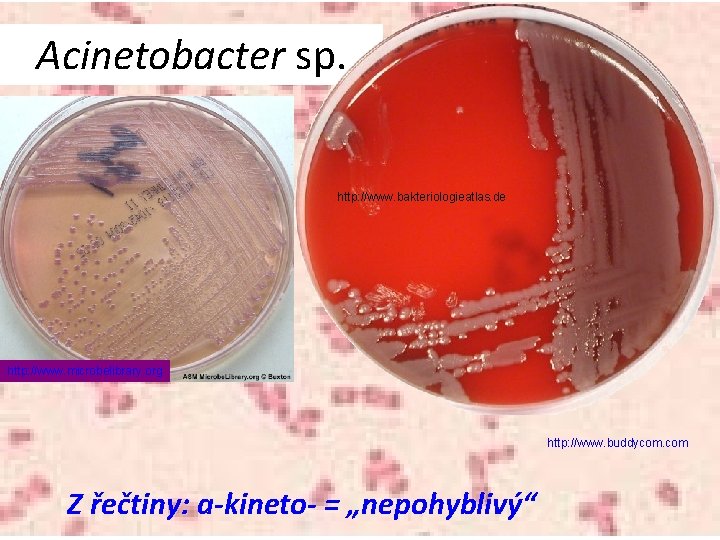 Acinetobacter sp. http: //www. bakteriologieatlas. de http: //www. microbelibrary. org http: //www. buddycom. com