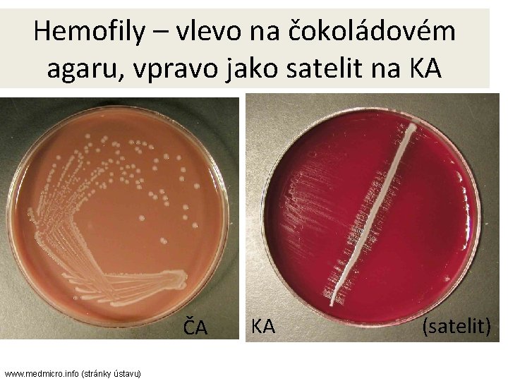 Hemofily – vlevo na čokoládovém agaru, vpravo jako satelit na KA ČA www. medmicro.