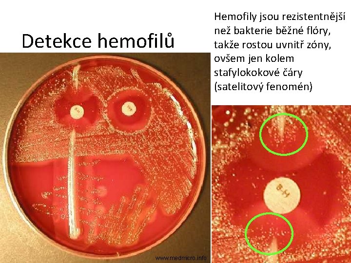 Detekce hemofilů www. medmicro. info Hemofily jsou rezistentnější než bakterie běžné flóry, takže rostou