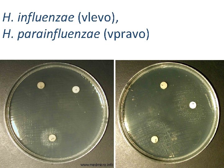 H. influenzae (vlevo), H. parainfluenzae (vpravo) www. medmicro. info 