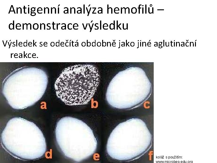 Antigenní analýza hemofilů – demonstrace výsledku Výsledek se odečítá obdobně jako jiné aglutinační reakce.