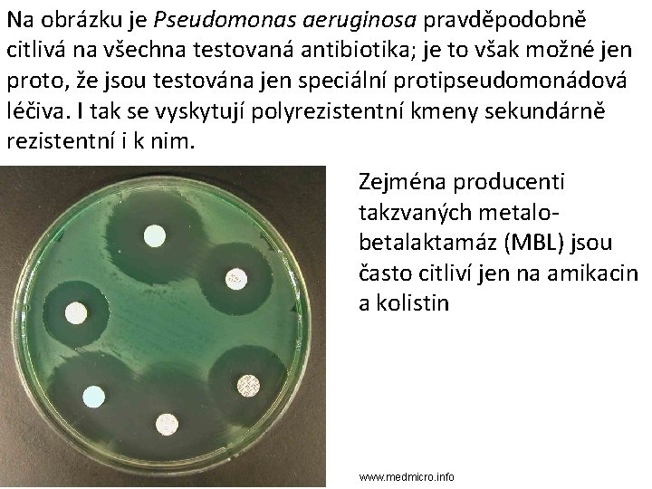 Na obrázku je Pseudomonas aeruginosa pravděpodobně citlivá na všechna testovaná antibiotika; je to však