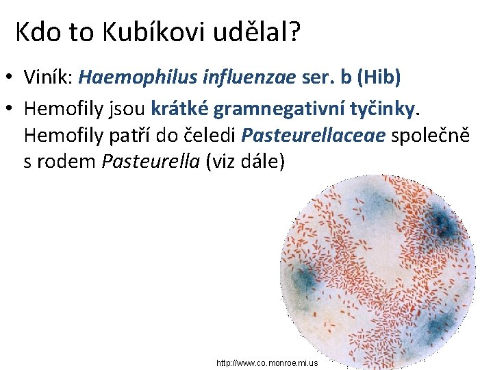 Kdo to Kubíkovi udělal? • Viník: Haemophilus influenzae ser. b (Hib) • Hemofily jsou