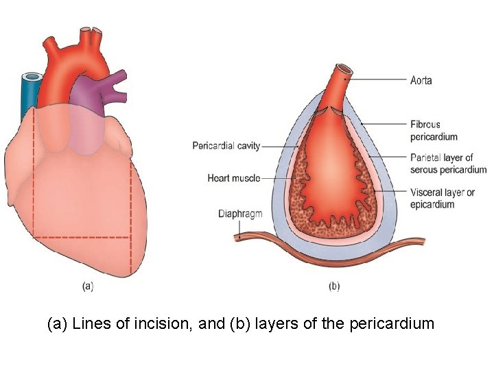 (a) Lines of incision, and (b) layers of the pericardium 