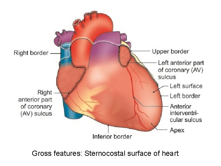 Gross features: Sternocostal surface of heart 