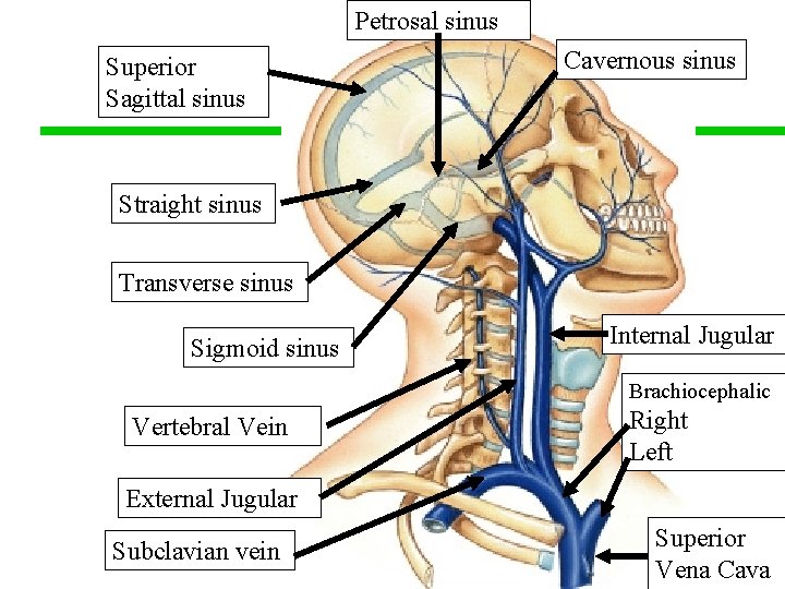 Petrosal sinus Superior Sagittal sinus Cavernous sinus Straight sinus Transverse sinus Sigmoid sinus Internal
