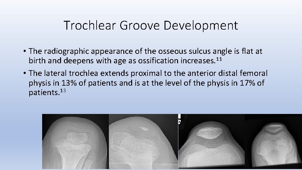 Trochlear Groove Development • The radiographic appearance of the osseous sulcus angle is flat