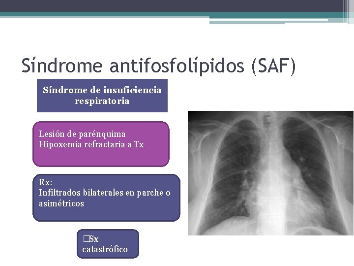 Síndrome antifosfolípidos (SAF) Síndrome de insuficiencia respiratoria Lesión de parénquima Hipoxemia refractaria a Tx