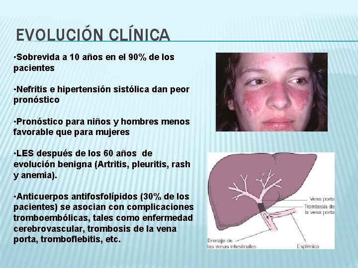 EVOLUCIÓN CLÍNICA • Sobrevida a 10 años en el 90% de los pacientes •