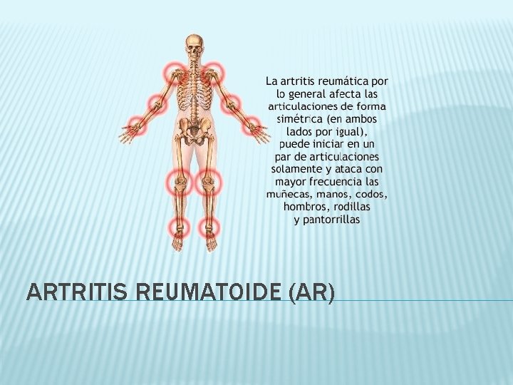 ARTRITIS REUMATOIDE (AR) 
